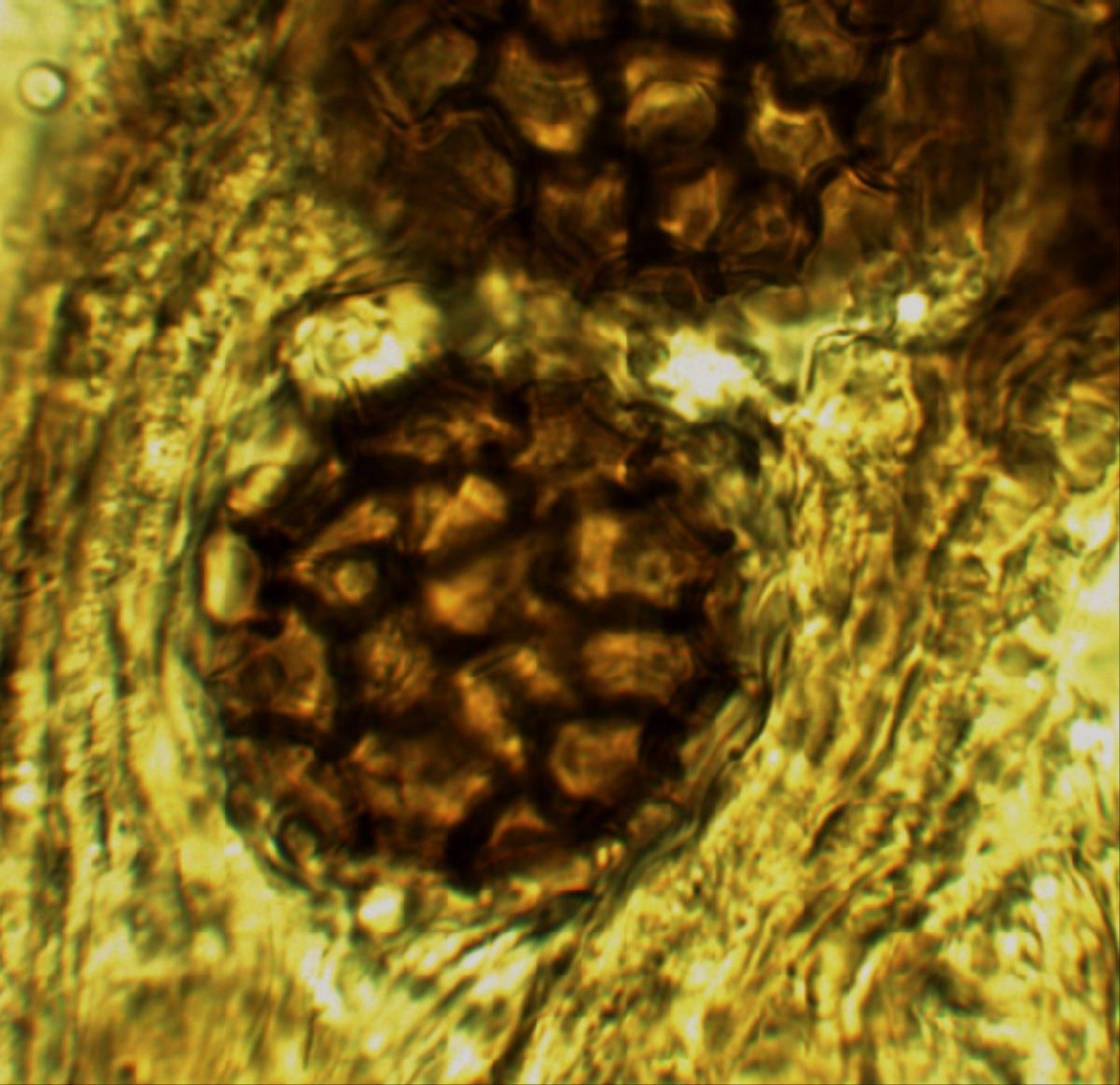 Sphaerosoma trispora image
