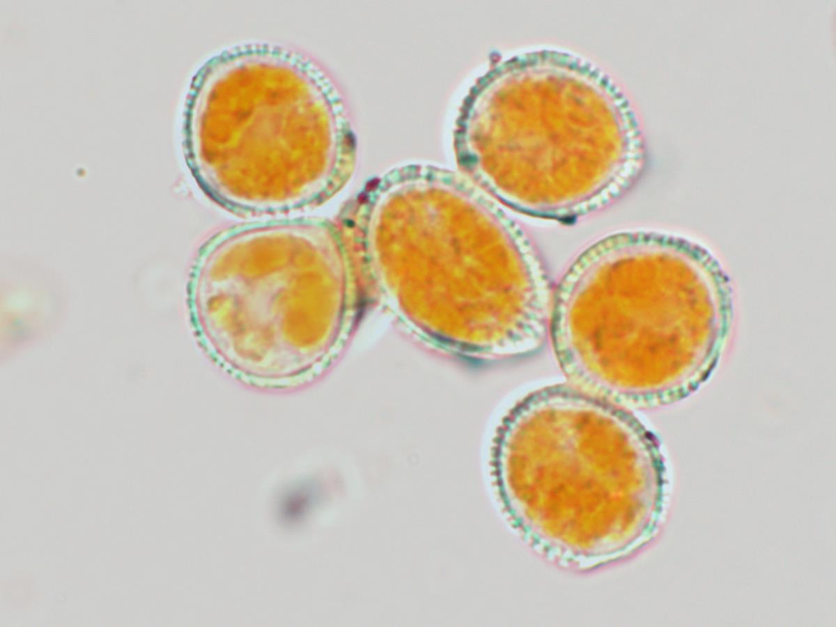 Chrysomyxa rhododendri image