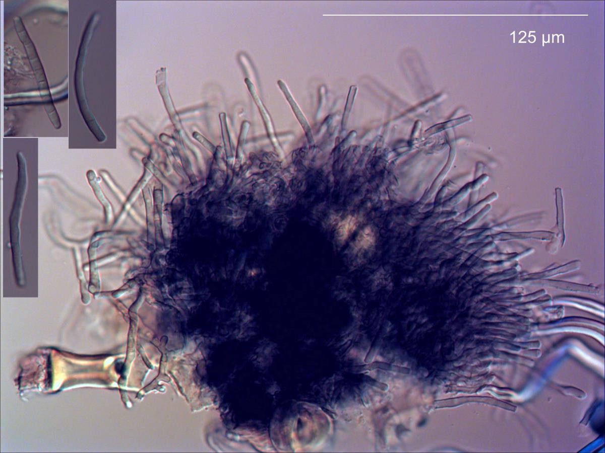 Pseudocercospora oleariae image