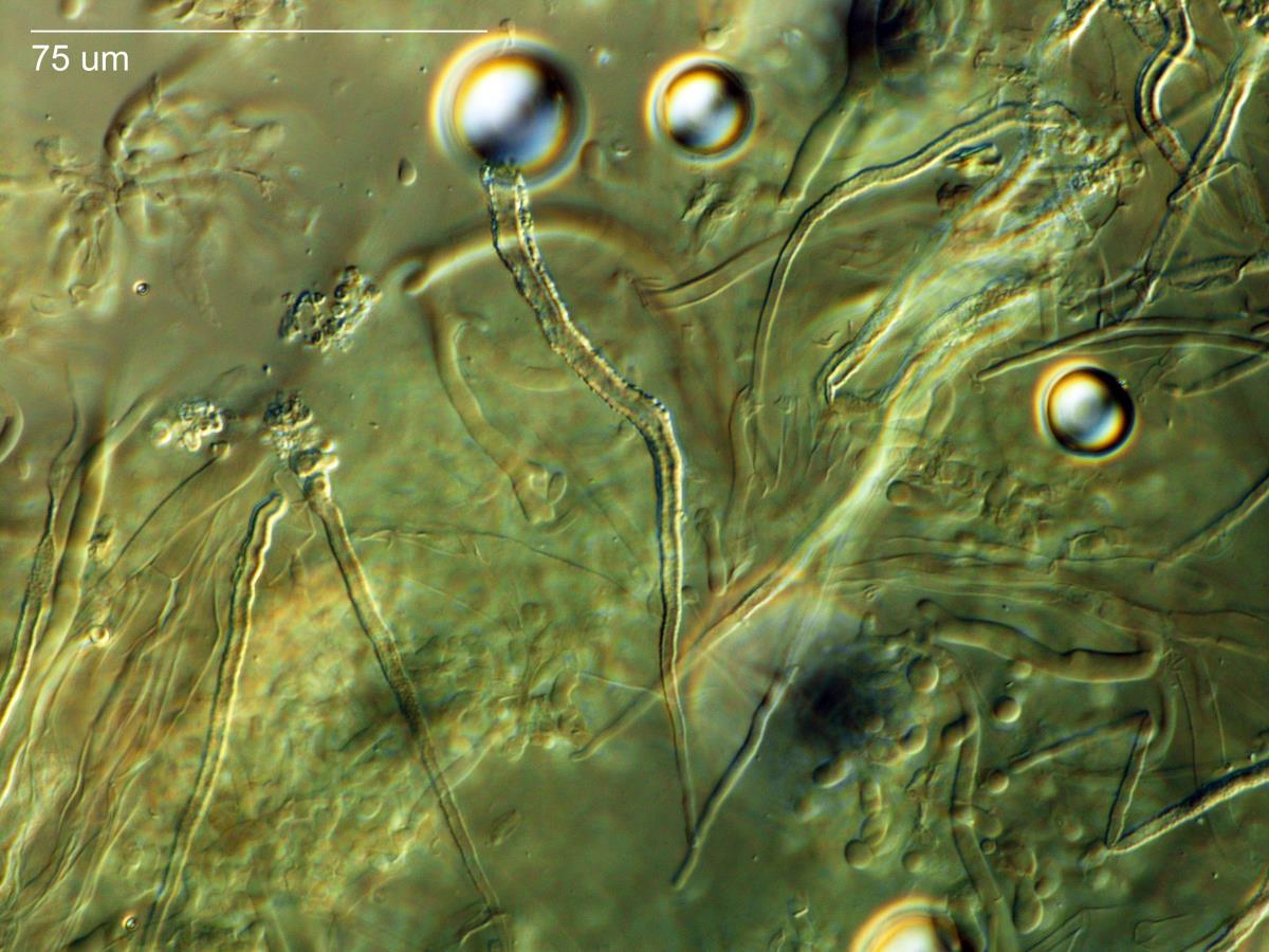 Incrustocalyptella pseudopanacis image