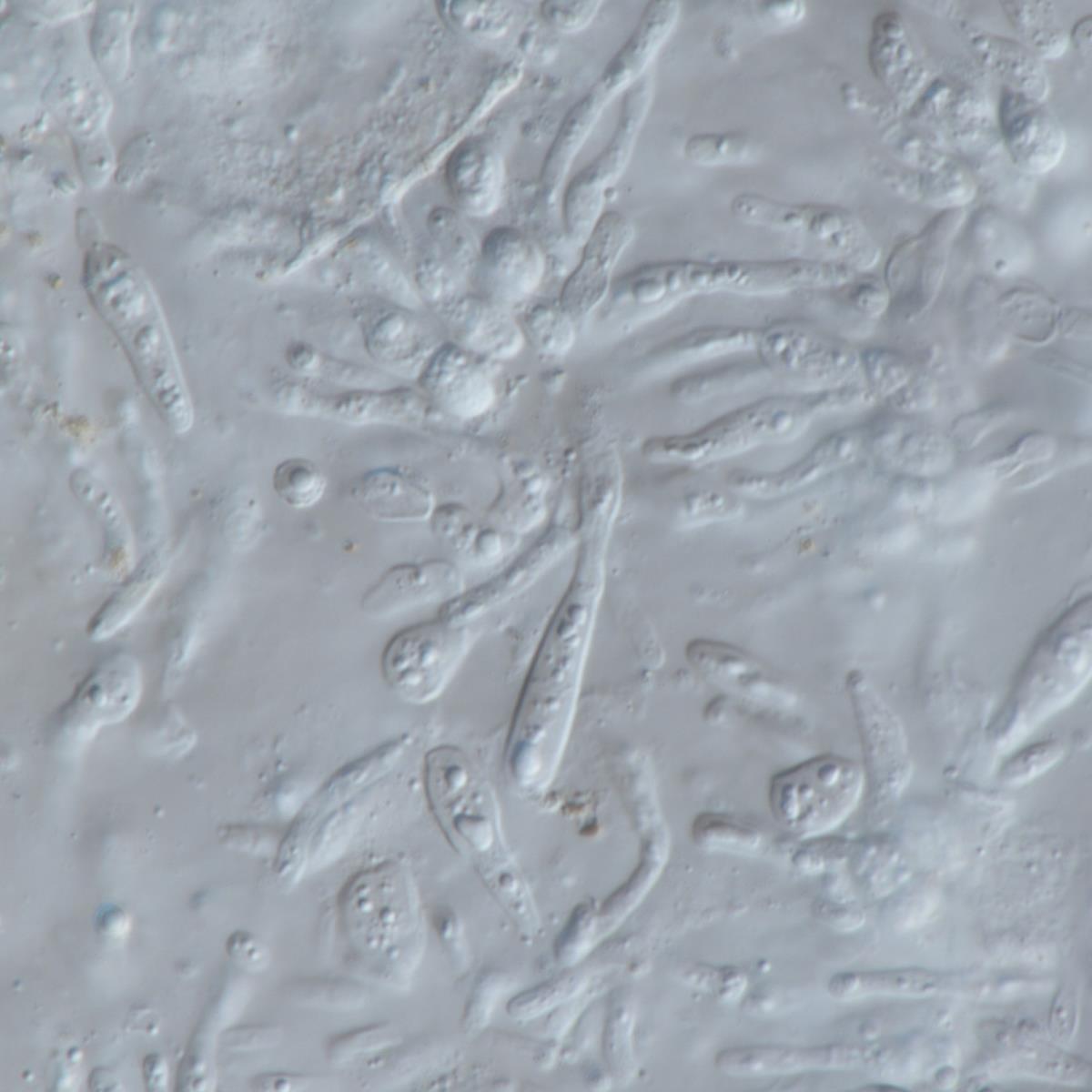 Tiarosporella image