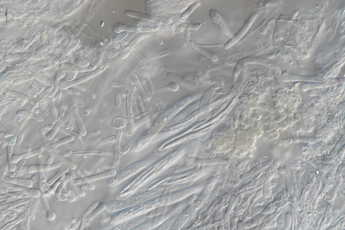 Lachnum hyalopus image