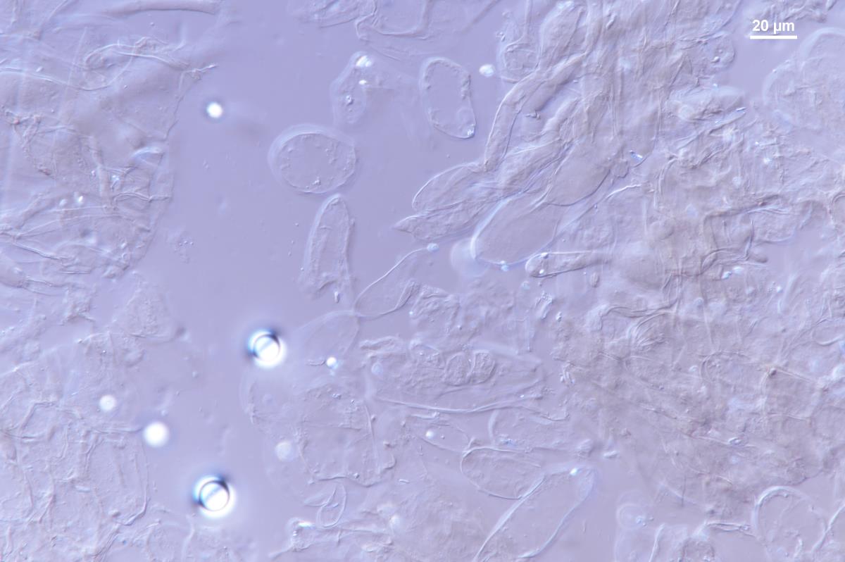 Coprinopsis macrocephala image