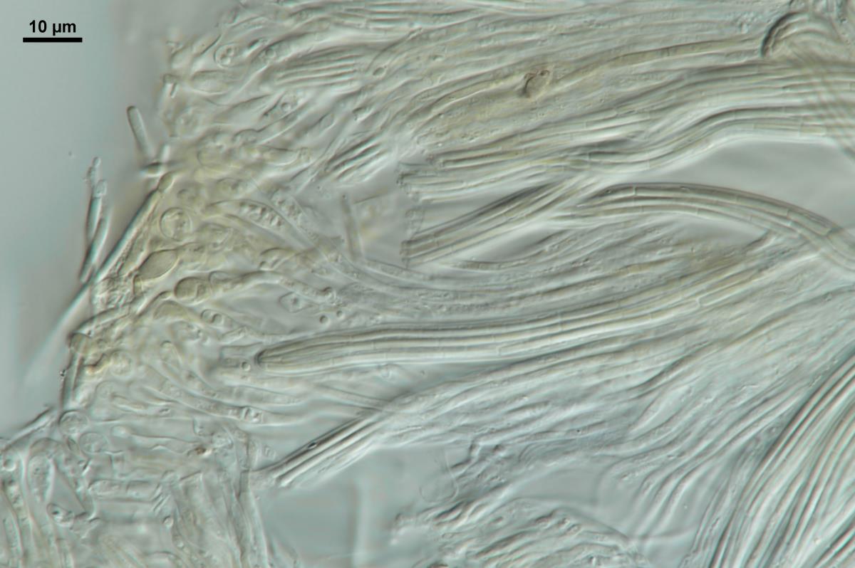 Vibrissea flavovirens image