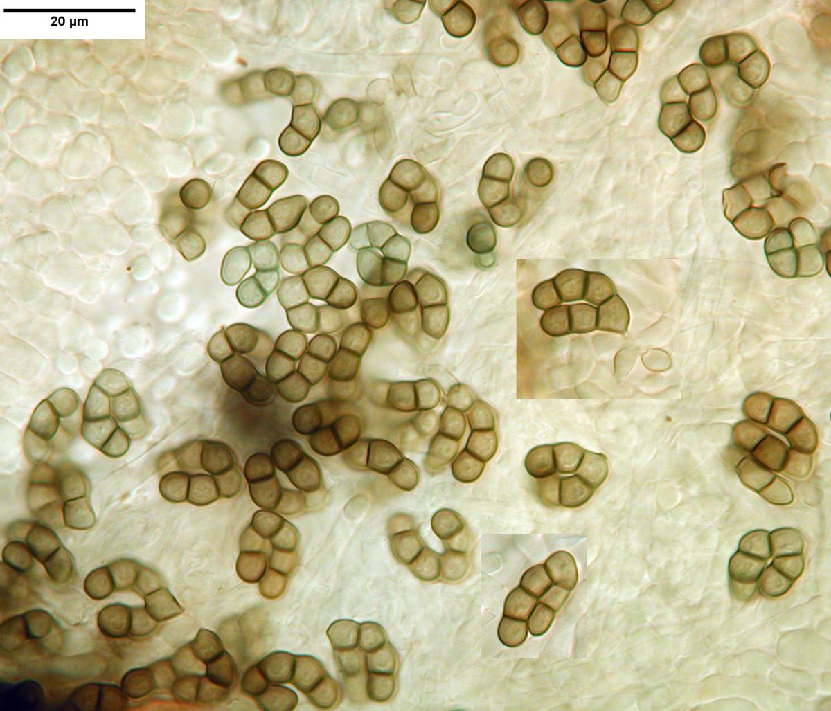 Cheiromycella microscopica image