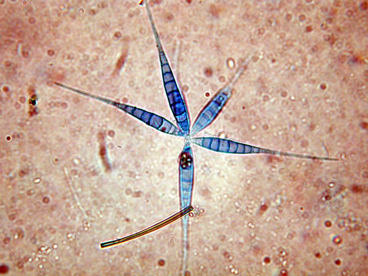 Flabellospora acuminata image