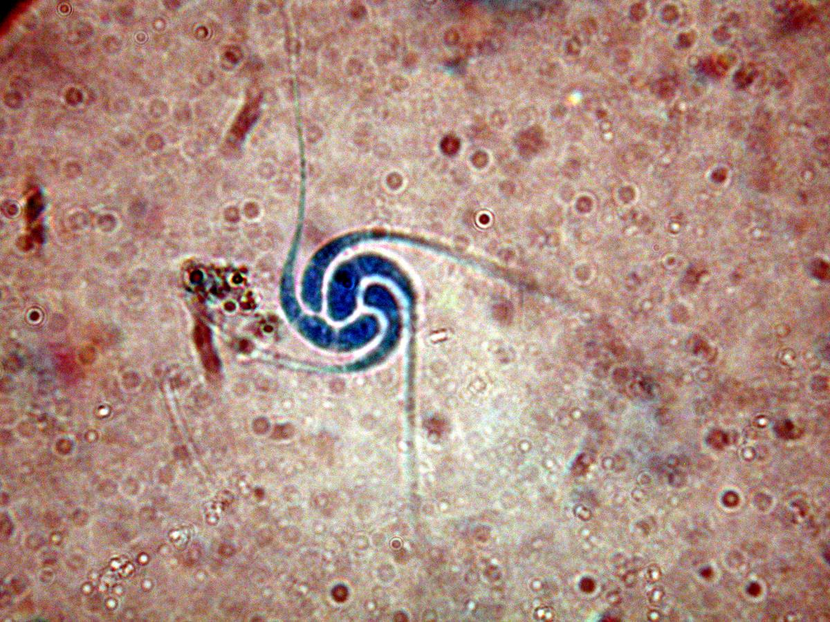 Gyoerffyella rotula image