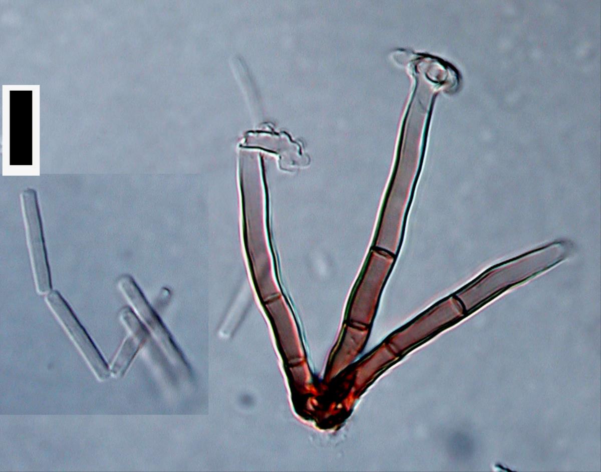 Polyscytalum gracilisporum image