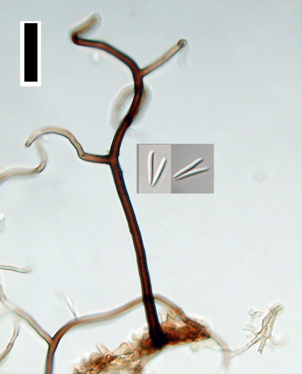 Gyrothrix podosperma image