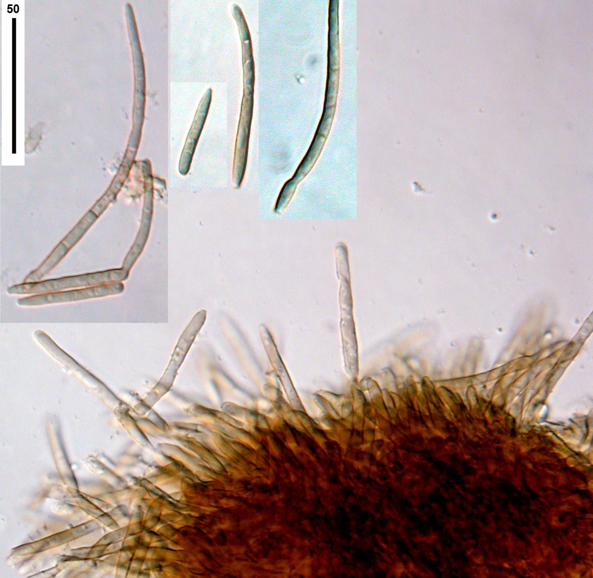 Pseudocercospora ackamae image