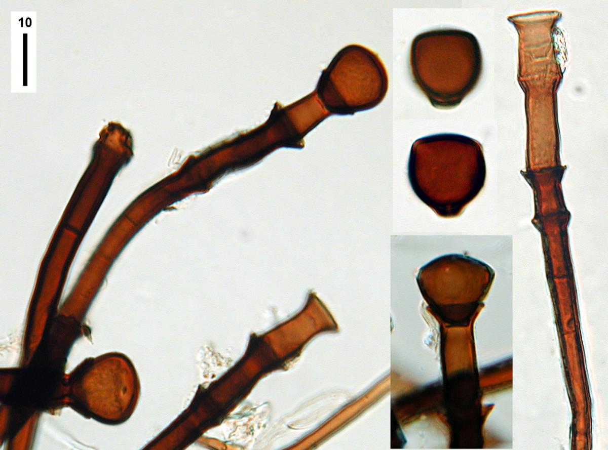 Chaetosphaeriaceae image