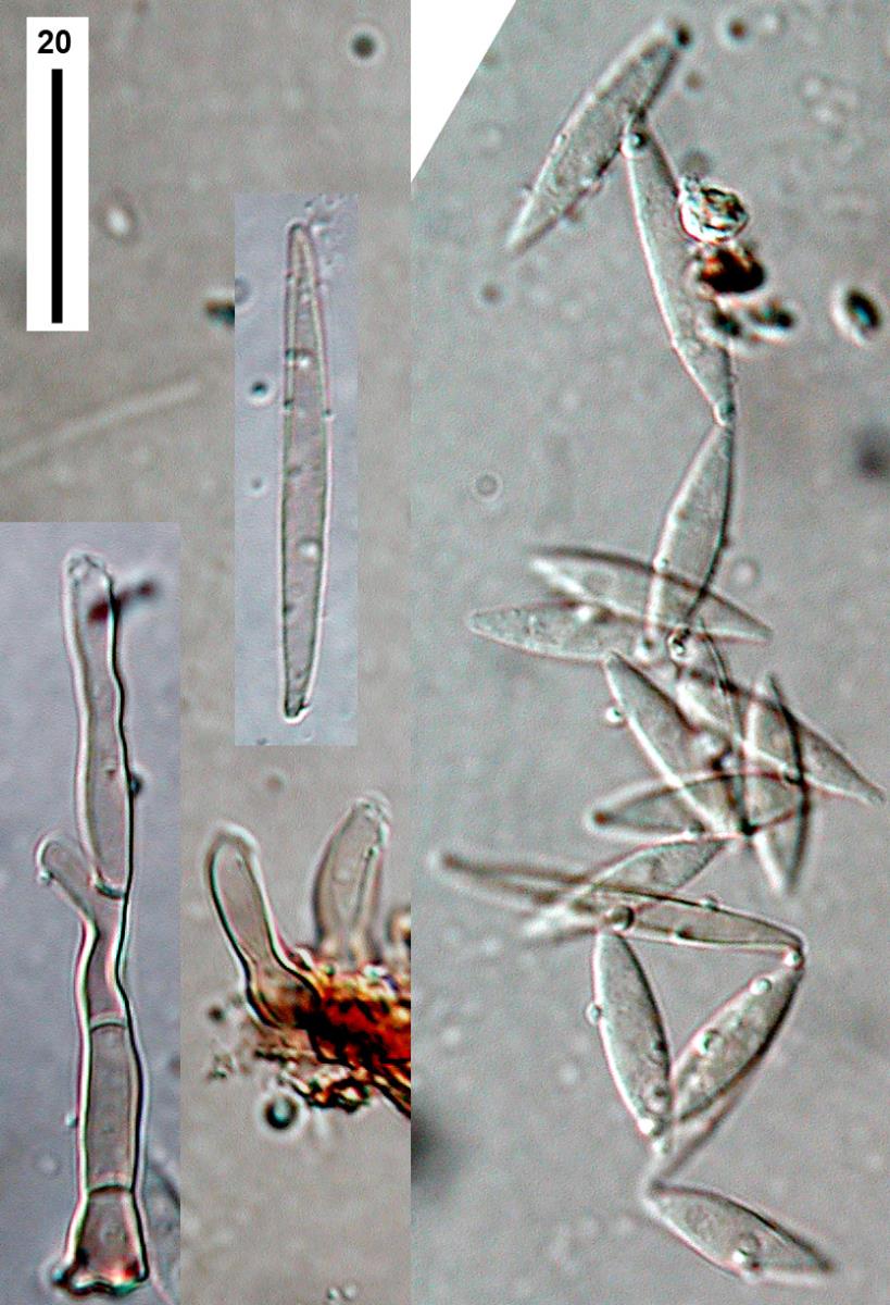 Subramaniomyces fusisaprophyticus image