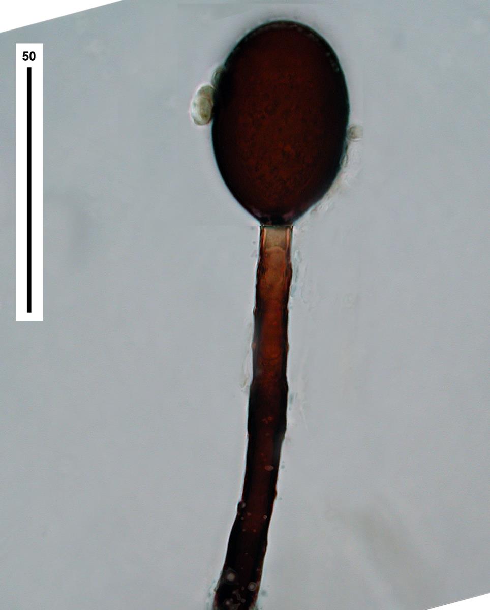 Acrogenospora gigantospora image