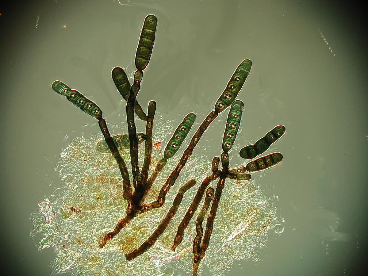 Dendryphiopsis image