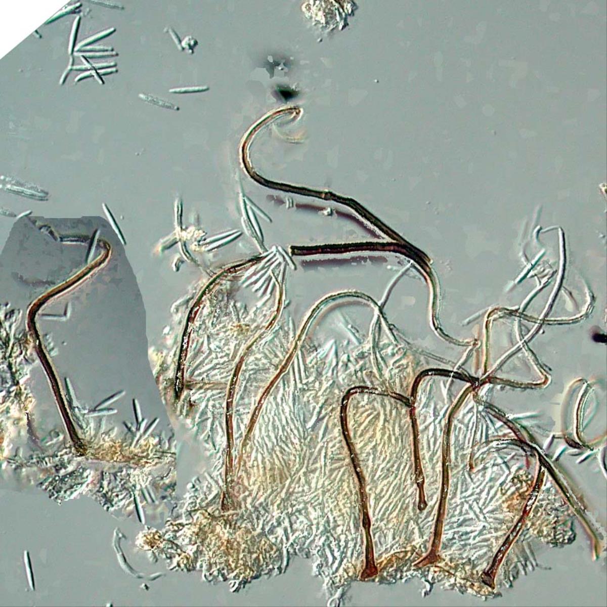 Circinotrichum maculiforme image