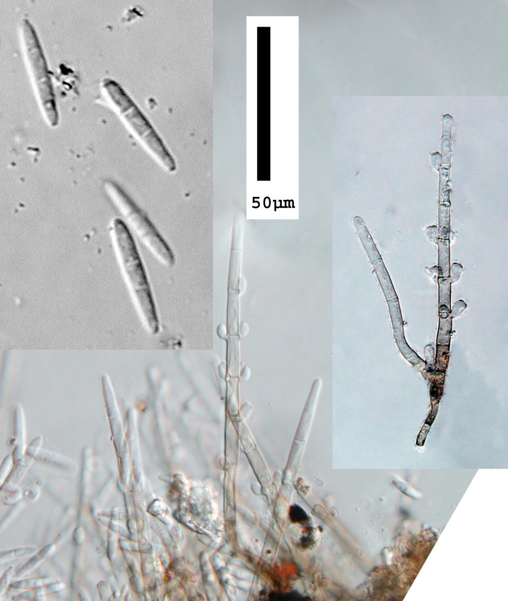 Spondylocladiopsis cupulicola image