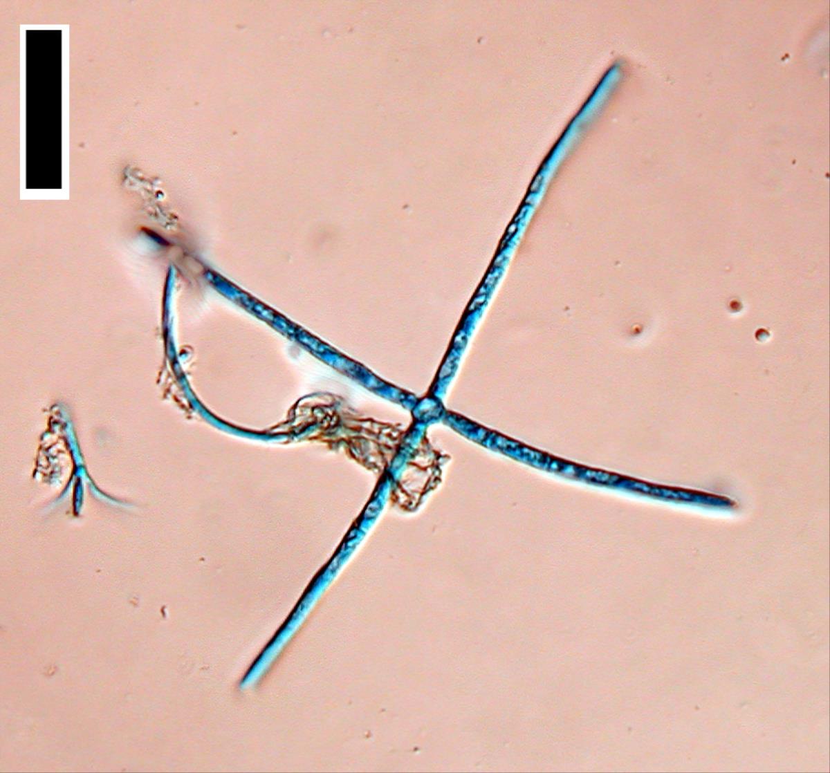 Lemonniera centrosphaera image