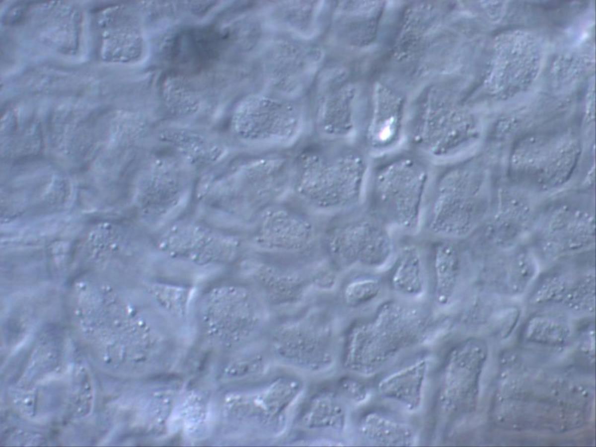 Micropodia filicea image