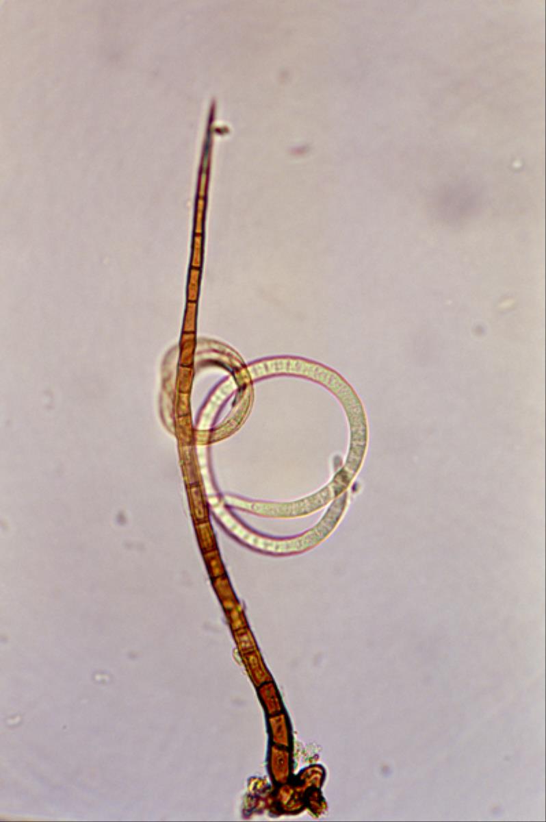 Thaxteriella helicoma image