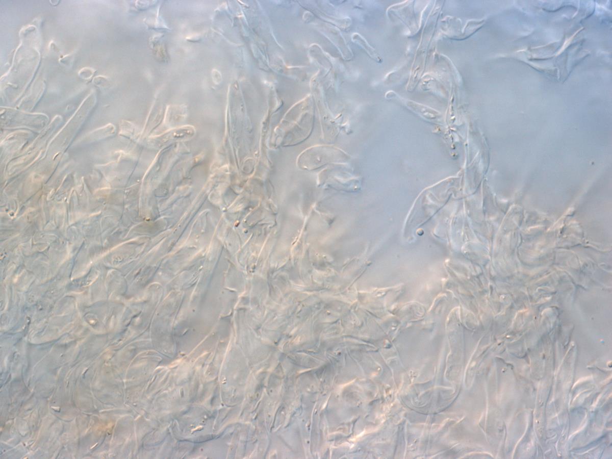 Helotium magellanicum image