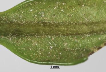 Karaka gall mite, Aculus corynocarpi (Acari: Eriophyidae) on the underside of a young leaf of karaka, Corynocarpus laevigatusi (Corynocarpaceae): note the white moulted skins. Creator: Tim Holmes. © Plant & Food Research. [Image: 2HFD]