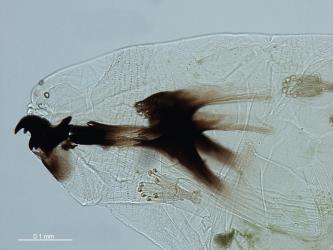 Mandibles and mandibular skeleton of larvae of the turnip leafminer, Scaptomyza flava (Fallen, 1823) (Diptera: Drosophilidae). Creator: Zheng Qi Zhao. © Landcare Research. [Image: 2HYK]