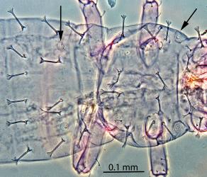 Dorsal (upper) side of larva of Palm thrips, Parthenothrips dracaenae (Thysanoptera: Thripidae): microscope slide preparation showing the setae (hairs) with expanded tips. The black arrows point to the stigmata (opening to breathing tubes) of the first abdominal segment (left) and the thorax (right). Creator: Nicholas A. Martin. © Landcare Research. [Image: 2J37]