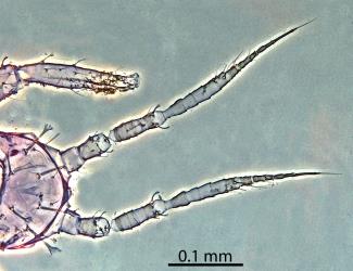 Dorsal (upper) side of head of a larva of Palm thrips, Parthenothrips dracaenae (Thysanoptera: Thripidae): microscope slide preparation showing the setae (hairs) with expanded tips and the antennae. Creator: Nicholas A. Martin. © Landcare Research. [Image: 2J38]