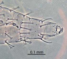 Ventral (under) side of the tip of the abdomen of a larva of Palm thrips, Parthenothrips dracaenae (Thysanoptera: Thripidae): microscope slide preparation showing the small setae (hairs) and ornamentation on the abdominal segments. Creator: Nicholas A. Martin. © Landcare Research. [Image: 2J3A]