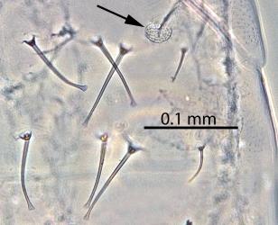 Dorsal (upper) side of the abdomen of a pupa of Palm thrips, Parthenothrips dracaenae (Thysanoptera: Thripidae) in a microscope slide preparation: note the round stigma on abdominal segment 1 (black arrow) and the setae (hairs) with expanded tips. Creator: Nicholas A. Martin. © Landcare Research. [Image: 2J3C]