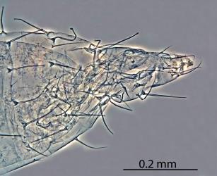 Side view of the abdomen of a pupa of Palm thrips, Parthenothrips dracaenae (Thysanoptera: Thripidae) in a microscope slide preparation: note the setae (hairs) with expanded tips. Creator: Nicholas A. Martin. © Landcare Research. [Image: 2J3D]