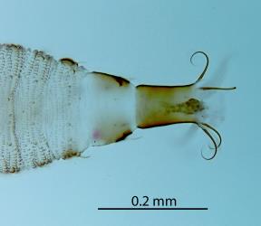 Ventral (under) side of the tip of the abdomen of a larva of Hangehange thrips, Sigmothrips aotearoana (Thysanoptera: Thripidae): microscope slide preparation showing the pigmentation and shape of the terminal segments, the long setae at the tip of the abdomen and the small setae (hairs) and ornamentation on the abdominal segments. Creator: Nicholas A. Martin. © Landcare Research. [Image: 2J4F]