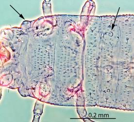 Dorsal (upper) side of larva of Banana silvering thrips, Hercinothrips bicinctus (Thysanoptera: Thripidae): microscope slide preparation with black arrows pointing to the stigmata (opening to breathing tubes) of the the thorax (left) and first abdominal segment (right). Creator: Nicholas A. Martin. © Landcare Research. [Image: 2J66]