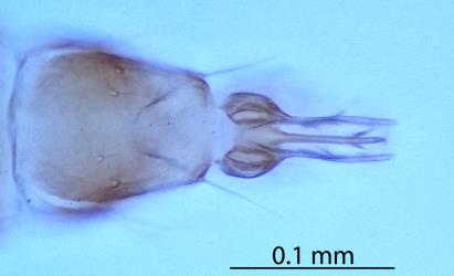 Microscope slide of the end of the abdomen of an adult male of Palm thrips, Parthenothrips dracaenae (Thysanoptera: Thripidae) showing the genitalia. Creator: Nicholas A. Martin. © Landcare Research. [Image: 2JDM]