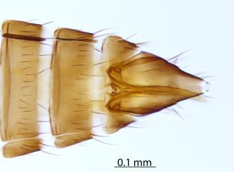 Photograph of a microscope slide of the tip of the abdomen showing the ovipositor of a female New Zealand flower thrips, Thrips obscuratus (Thysanoptera: Thripidae). Creator: Nicholas A. Martin. © Landcare Research. [Image: 2ZJQ]