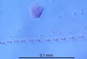 Photograph of a microscope slide preparation showing the 8-shaped pores on the margin the body of a female Kanuku orange scale, Asterolecanium vitreum (Hemiptera: Asterolecaniidae). Creator: Nicholas A. Martin. © Landcare Research. [Image: 31WW]