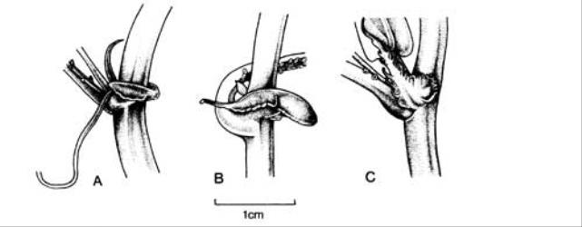 Fig. 93. Stipules of  Passiflora. A  P. mixta; B  P. mollissima; C  P. × rosea. © All rights reserved. [Image: 4X6M]