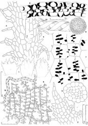 Fig. 10. Neogrollea notabilis E.A.Hodgs. 1. Innermost bracts, and in middle, bracteole, abaxial view; note various lamellae and lobes on adaxial face shown in stipple outline. 2. Lobe of innermost ♀ bract. 3, 4. Portions of lamina margin of 2 innermost ♀ bracts. 5. Seta, cross section. 6. Capsule wall, cross section. 7. Capsule wall, outer layer (drawn to same scale as Fig. 8). 8. Capsule wall, inner layer. 9. Spore and portion of elater at same magnification (× 1382). 10. Elater (× 468). (All from Braggins JEB502A, New Zealand, South Is., Western Nelson EP, ca. 0.5 km from Denniston.). © All rights reserved. [Image: 4XW0]