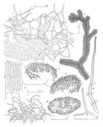 Fig. 22. Castanoclobos julaceus (Hatcher ex J.J.Engel) J.J.Engel & Glenny. 1. Ventral sector of leaf, adaxial aspect (some portions of marginal armature not shown for clarity). 2. Shoot, dorsal view. 3. Median cells of lamina. 4. Leaf, adaxial view. 5. Leaf, abaxial view. 6. Cross section of shoot showing mass of interwoven, branched cilia (UL = underleaf) of 1 gyre. 7. Underleaf (some portions of marginal armature not shown for clarity). 8. Leaf lobe, distal sector. 9. Lateral armature of leaf lobe, distal sector. (All from holotype.). © All rights reserved. [Image: 4XWD]