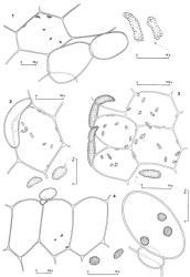 Fig. 110. Oil-bodies. 1. Zoopsis matawai M.A.M.Renner. Stem cell with oil-bodies, at right 2 oil-bodies at higher magnification (+ leaf lobe). 2. Zoopsis argentea var. flagelliformis (Colenso) R.M.Schust. Thallus cell with oil-bodies, below 2 oil-bodies at higher magnification. 3. Zoopsis setulosa Leitg. Thallus cells with oil-bodies, at lower right an oil-body at higher magnification. 4. Zoopsis bicruris Glenny & E.A.Brown. At left 3 cortical cells with a leaf, below right 2 oil-bodies at higher magnification; at right a leaf cell with 3 oil-bodies. (Fig. 1, from Glenny 9097, New Zealand, South Is., Westland EP, Mt. Brown; 2, from Glenny 9236, New Zealand, South Is., Western Nelson EP, Takaka Hill, Harwoods Hole Track; 3, from Glenny 8877, New Zealand, South Is., Westland EP, Mt. Te Kinga, Lake Swan; 4, from Glenny 9098, New Zealand, South Is., Westland EP, Mt. Brown.). © All rights reserved. [Image: 4XYW]