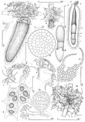 Fig. 124. Trichotemnoma corrugatum (Steph.) R.M.Schust. 1. Leaf, adaxial aspect (DL = dorsal lobe). 2. Leaf, abaxial aspect (DL = dorsal lobe). 3. Cells of disc showing dimorphic oil-bodies, some large and papillose, others small, homogeneous and smooth; note also the chloroplasts (cross hatch shading). 4. Underleaf (in situ) showing rhizoids with digitate tips. 5. Rhizoid with digitate tip. 6. Portion of main shoot with marsupium on a short, ventral-intercalary branch, ventral-lateral view; note rings of bractlets at summit of marsupium and also the leaf insertion. 7. Median-longitudinal section of marsupium; note the strongly abbreviated ventral-intercalary branch (VIB), the tuft of bractlets (= BL) at the summit, the calyptra (= CAL), with 2 unfertilized archegonia at the extreme base (one at UA, the other to left), the seta (= S), and the foot (= F), with the scalloped haustorial collar. 8. Young sporophyte, note elaborated, sheet-like haustorial collar. 9. Seta, cross section. 10. Portion of main shoot with androecium in axil of lowermost underleaf, ventral view; note 2 antheridia are visible in axils of each of uppermost bracts (= ♂). 11. Portion of ♂ bract. 12. Antheridium. 13. Antheridial stalk. (Figs. 1, 2, 6–13, from Engel 22005, New Zealand, South Is., Fiordland Natl. Park, Milford Sound, track to Bowen Falls; 3, from Glenny 8910, New Zealand, South Is., Western Nelson EP, Waimangaroa R.; 4, 5, from Engel 23197, same loc. as Engel 22005.). © All rights reserved. [Image: 4XZA]