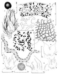 Fig. 139. Chandonanthus squarrosus (Hook.) Mitt. 1. Gynoecium with mature sporophyte, dorsal-lateral view (the 2 lower bracts on right side removed); note the accessory lobes on bracts (bre = bracteole). 2. Capsule wall, cross section. 3. Perianth, cross section through median portion. 4. Capsule wall, outer layer. 5. Capsule wall, inner layer. 6. Elater. 7. Spore. 8–10. Bracts and bracteole (= BRE) from same innermost series, abaxial view; note fringe of paraphyllia at bases. 11. Paraphyllia on abaxial surface of base of innermost bract (BB = bract base). (Figs. 1, 6–11, from Engel 13771, Tasmania, Near Scotts Peak Road, E of S end of Lake Gordon; 2, 4, 5, from Engel 15119, Tasmania, Sentinel Ra., between Lakes Gordon and Pedder; 3, from Engel 14305, Tasmania, Cradle Mtn.–Lake St. Clair Natl. Park.). © All rights reserved. [Image: 4XZQ]