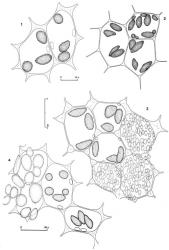 Fig. 152. Oil-bodies, all (except Fig. 2) with the outline of a few chloroplasts included. 1. Solenostoma inundatum (Hook.f. & Taylor) Mitt. ex Steph. Median leaf cells. 2. Solenostoma inundatum (Hook.f. & Taylor) Mitt. (× 875). Median leaf cells. 3. Solenostoma rufiflorum (Colenso) J.J.Engel. Upper-median leaf cells; note that papillose surface is shown for 3 cells. 4. Solenostoma totipapillosum (E.A.Hodgs.) R.M.Schust. Median leaf cells; note that papillose surface is shown at left. (Fig. 1, from Glenny 9115, New Zealand, South Is., Westland EP, Upper Otira Valley; 2, from Engel 22439, New Zealand, North Is., Wellington, Tongariro Natl. Park, Taranaki Falls Track; 3, from Glenny 9693, New Zealand, South Is., Westland EP, Dickie Ridge; 4, from Glenny 9291, New Zealand, South Is., Western Nelson EP, Moonlight Creek.). © All rights reserved. [Image: 4Y04]