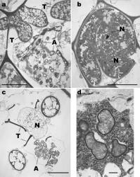 Fig. 2. Transmission electron micrographs of Marchantia foliacea illustrating typical features of glomeromycote associations in New Zealand Marchantiales and Metzgeriales. a. Early infection stage showing numerous arbuscules (= A) and trunk hyphae (= T). b. Multinucleate fungal vesicle filling a host cell (N = nuclei). c. Late infection stage showing collapsed trunk hyphae (= T) and arbuscules (= A) (N = host cell nucleus). d. Gram-positive bacteria typical of all liverwort glomeromycote fungi. Scale bars: 10 µ (a, b), 5 µ (c), 200 nm (d). © All rights reserved. [Image: 4Y17]