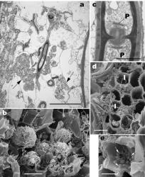 Fig. 3. Transmission (a, c) and scanning (b, d, e) electron micrographs illustrating typical features of basidiomycete associations in New Zealand liverworts. a–c. Verdoornia succulenta. a. Heavily infected cell containing a mixture of healthy and collapsed hyphal masses (arrowed) from an earlier infection cycle. b. Hyphal coils in host cells. c. Dolipore septum with imperforate parenthosomes (= P) typical of all basidiomycetes in liverworts. d, e. Diplophyllum dioicum. d. Ventral part of a stem showing a mosaic of infected (= I) and uninfected cells. e. Ingress of hyphae into uninfected cells is prevented by overgrowths of host cell wall (arrowed). Scale bars: 10 µ (a, e), 20 µ (b, d), 1 µ (c). © All rights reserved. [Image: 4Y18]