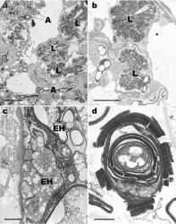 Fig. 4. Transmission electron micrographs of the unique features of the fungal associations in Haplomitrium and Treubia. a. Haplomitrium gibbsiae, fungal arbuscules (= A) and lumps (= L) in a heavily infected epidermal cell from a subterranean axis. b, c. Treubia lacunosa. b. Fungal lumps (= L) in a ventral thallus cell. c. Pseudoparenchymatous extracellular hyphae (= EH) in mucilagefilled intercellular spaces within a thallus. d. Treubia pygmaea. Fungal spore with a very thick multilayered wall in a mucilage-filled intercellular space. Scale bars: 5 µ (a, b), 2 µ (c), 1 µ (d). © All rights reserved. [Image: 4Y19]