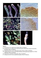 Plate 16A  Herzogobryum teres, distal sector of shoots. Photo. W. Malcolm. B  Herzogobryum teres, distal sector of leaf showing thin-walled hyaline margin and asperulate leaf surface. Photo, W. Malcolm. C  Nothogymnomitrion erosum, whole plants among Andreaea. Photo, W. Malcolm. D  Nothogymnomitrion erosum, leaf margins and apex, showing projecting marginal row of thick-walled cells. Photo, W. Malcolm. E  Gymnomitrion cuspidatum, whole plants. Photo, W. Malcolm. F  Nothogymnomitrion erosum, perianth and capsule. Photo, W. Malcolm. © All rights reserved. [Image: 4Y1H]